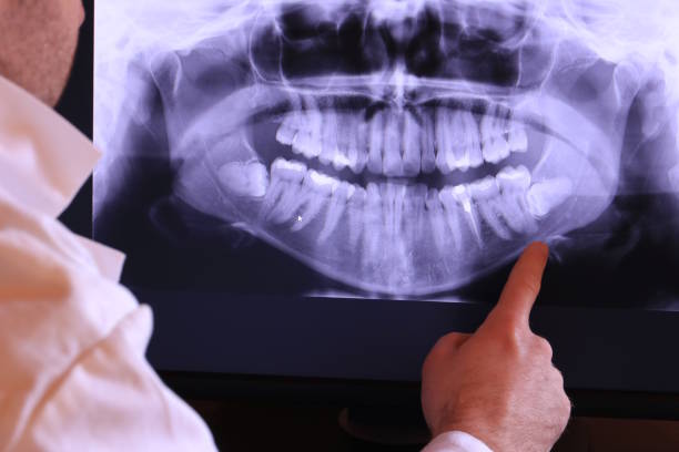 Best Emergency Gum Treatment in Summit View, WA