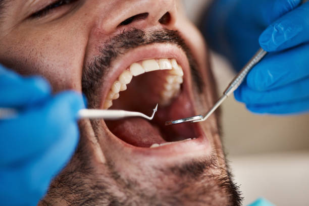 Best Weekend Emergency Dentist in Summit View, WA